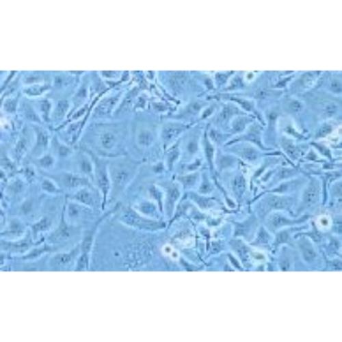 Human Oesophageal Squamous Cell Carcinoma, #KYSE-410