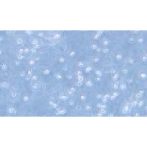 Human Multiple Myeloma Cell Line, #MM.1R