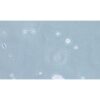 Human Non-Small-Cell Lung Cancer Cell Line, #NCI-H524