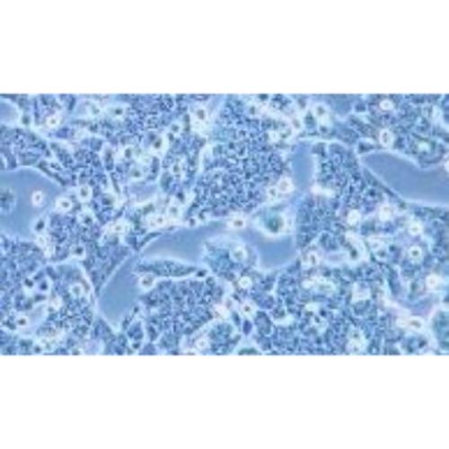 Human Lung Cancer Cell Line, #NCI-H1944