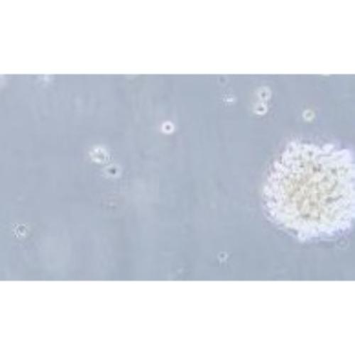 Natural Killer Cell Line In Human Patients With Malignant Non-Hodgkin's Lymphoma, #NK-92