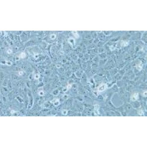 Human Normal Thyroid Cell Line, #NTHY-ORI 3-1