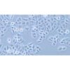 Human Pancreatic Cancer Cell Line, #PANC 03.27