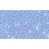 Human Poorly Differentiated Lung Adenocarcinoma Cell Line, #SK-LU-1