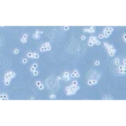 Human Gastric Carcinoma Cell, #SNU-1