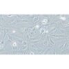 Human Glioma, #TJ905