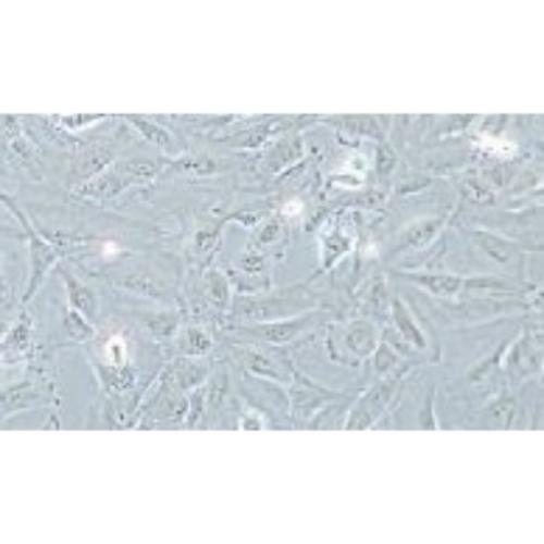 Human Glioma, #TJ905