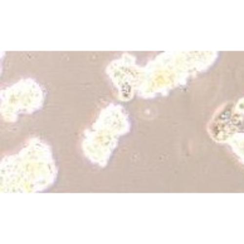 Human Breast Cancer Cell, #ZR-75-1