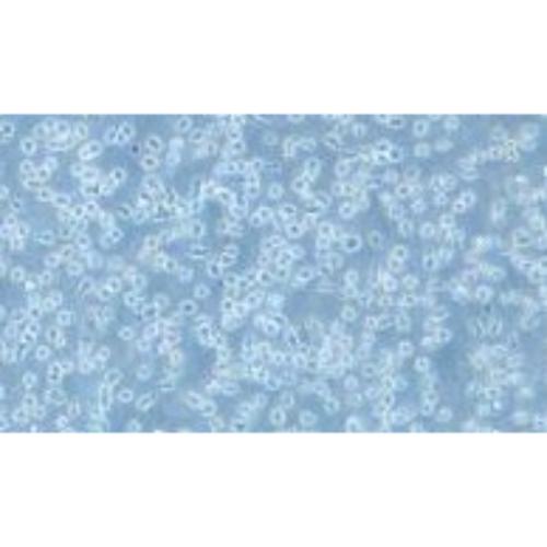 Human Mantle Cell Lymphoma Cell Line, #JEKO-1