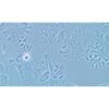 Human Breast Cancer Cell, #MDA-MB-415