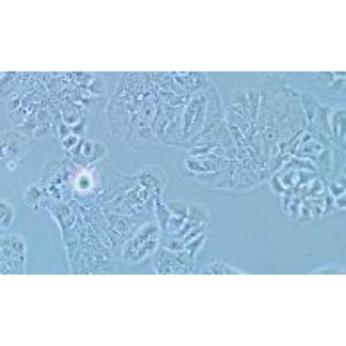 Human Breast Cancer Cell, #MDA-MB-415