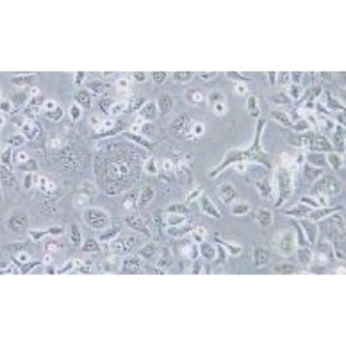 Human Cervical Epidermal Carcinoma Cell Line, #ME-180