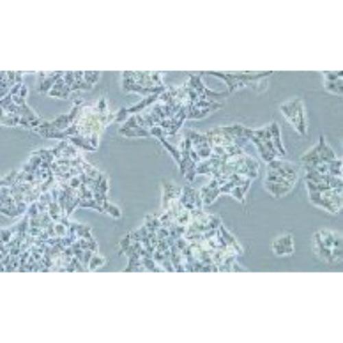 Human Adrenocortical Fine Adenocarcinoma Cell Line, #NCI-H295R
