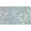 Human Ocular Eye Envelope Melanoma Cell Line, #OCM 1A