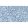 Normal Cell Line Of The Human Prostate Gland, #RWPE-1
