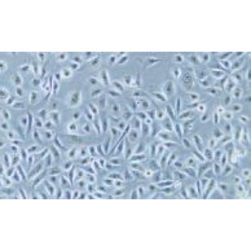 Normal Cell Line Of The Human Prostate Gland, #RWPE-1
