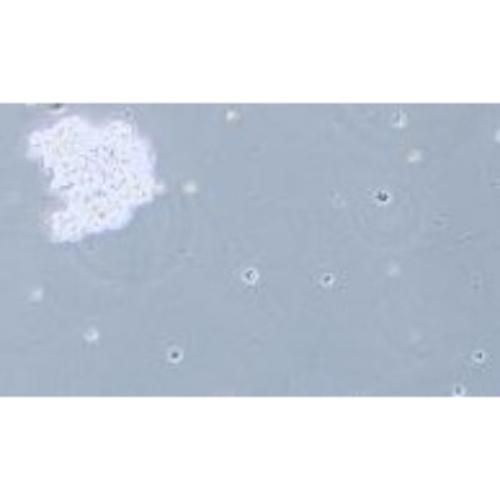 Human Small-Cell Lung Cancer Cell Line, #SHP-77