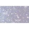Human Esophageal Cancer Cell Line, #TE-12