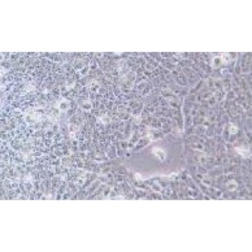 Human Esophageal Cancer Cell Line, #TE-12