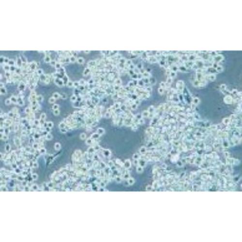 Human Gastric Carcinoma Cell, #MKN-45