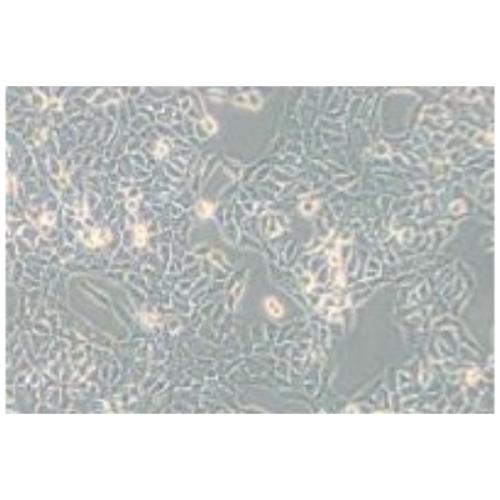 Human Bladder Cancer Cell Line, #RT112