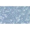 Human Degenerative Cancer Cell Line, #CALU-6