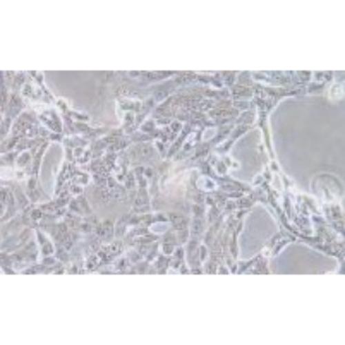 Human Pancreatic Cancer Cell Line, #CFPAC-1