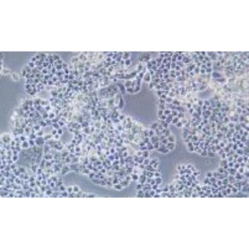 Granulosa Tumor Cell Line Of The Human Ovary, #COV434