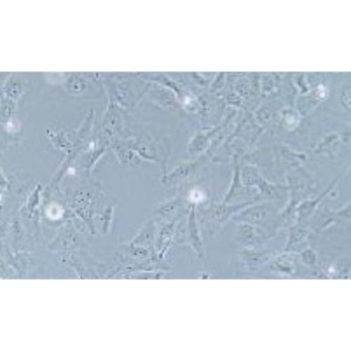 Human Breast Ductal Cancer Cell Line, #HCC 38