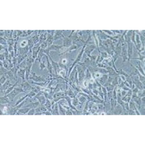 Human Ovarian Cancer Cell Line, #HEY