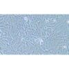 Human Ovarian Cancer Cell Line, #HEY A8