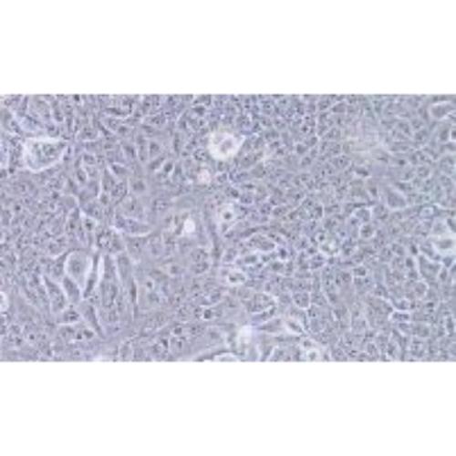 Human Breast Cancer Cell, #JIMT-1