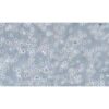 Human Degenerated Large-Cell Lymphoma Cell Line, #KARPAS-299