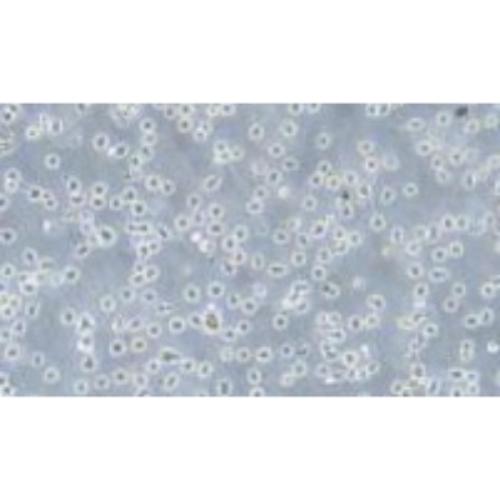 Human Degenerated Large-Cell Lymphoma Cell Line, #KARPAS-299