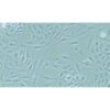 Human Thyroid Cancer Cell Line, #KTC-1