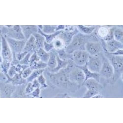 Human Adenocarcinoma Cell Line Of Non-Small-Cell Lung Cancer, #NCI-H522