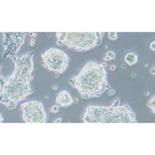 Human Classic Small-Cell Lung Cancer Cell Line, #NCI-H1688
