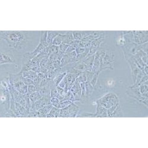 Human Lung Cancer Cell Line, #NCI-H2228