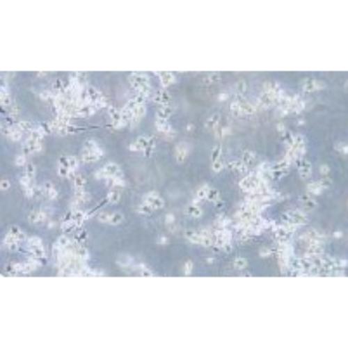 Human, Diffuse Large B-Cell Lymphoma Cell Line, #OCI-LY3