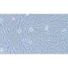 Human Thyroid Carcinoma Cell Line (Undifferentiated), #OCUT-2C