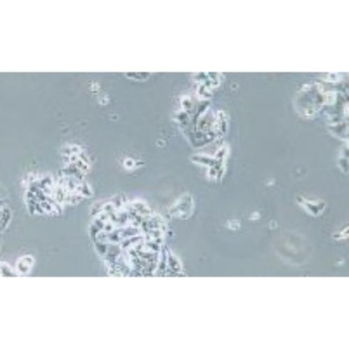 Human Esophageal Cell Line, #OE19