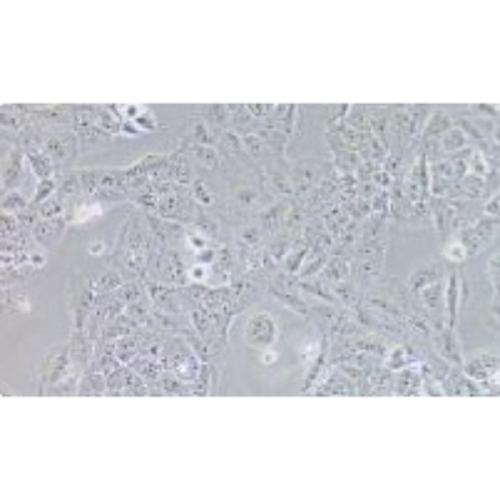 Human Ovarian Cancer Adenocarcinoma Cell Line, #OVCAR-8