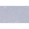 Human Osteosarcoma Cell Line, #SJSA-1