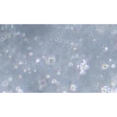 Human B-Cell Lymphoma Cell Line, #SU-DHL-2