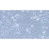 Human Epithelial Ovarian Cancer Cell Line, #TOV-112D