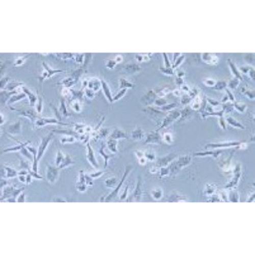 Human Epithelial Ovarian Cancer Cell Line, #TOV-112D