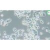 Human Breast Cancer Cell, #ZR-75-30
