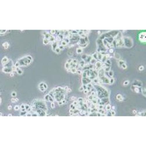 Human Breast Cancer Cell, #ZR-75-30