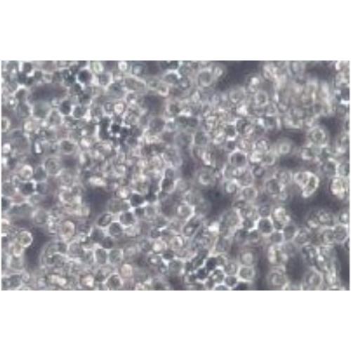 Human Philadelphia Chromosome-positive (Ph+) Acute Lymphoblastic Leukemia (ALL) Cell Line, #SUP-B15