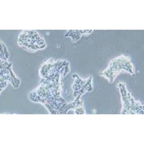 Human Breast Cancer Cell Line, Luciferase Labeled #ZR-75-1+LUC